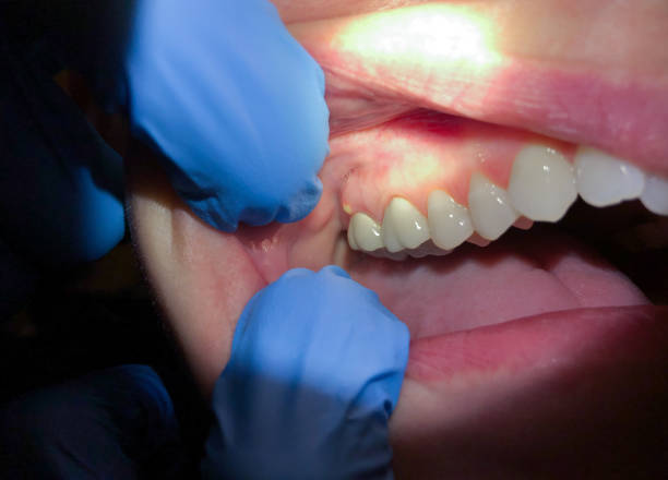 Best Weekend Emergency Dentist in Zephyrhills North, FL